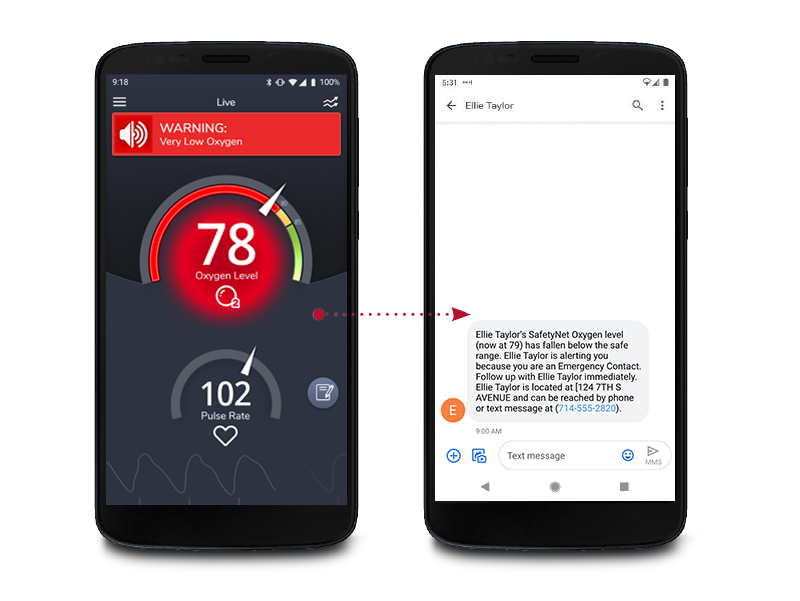 COVID-19 : Le smartphone pour surveiller sa saturation en oxygène à  domicile